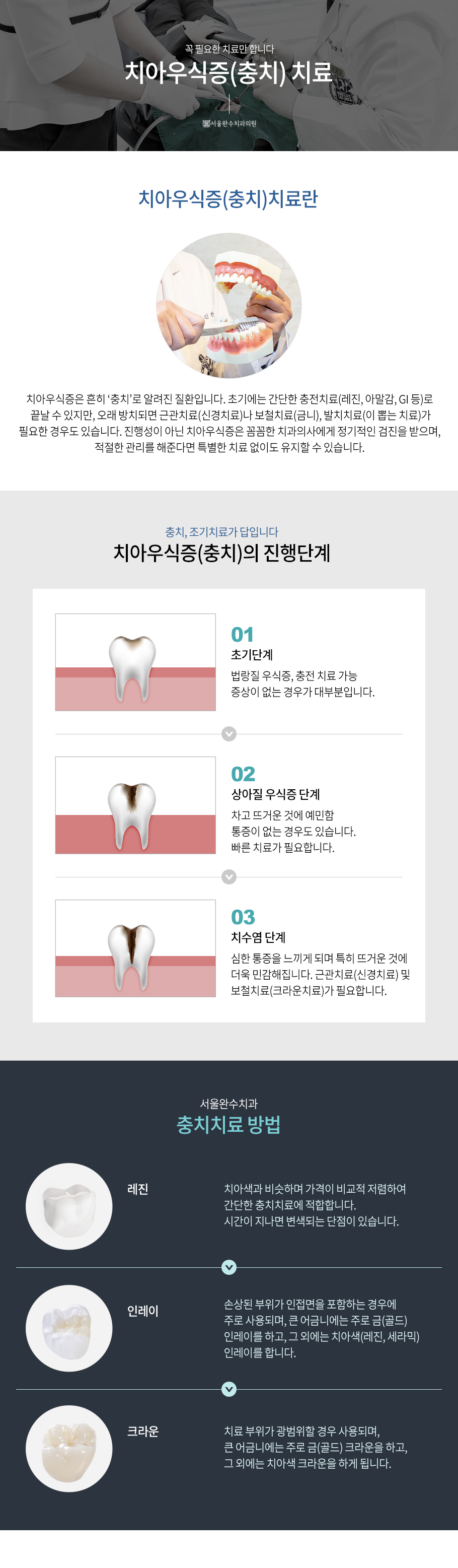 충치치료