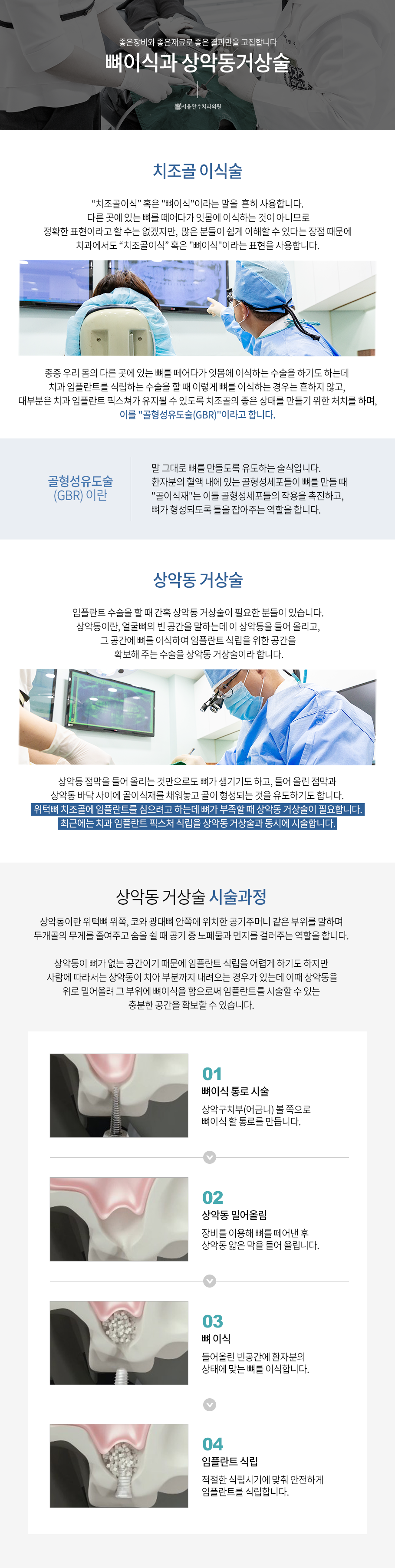 자가혈 임플란트