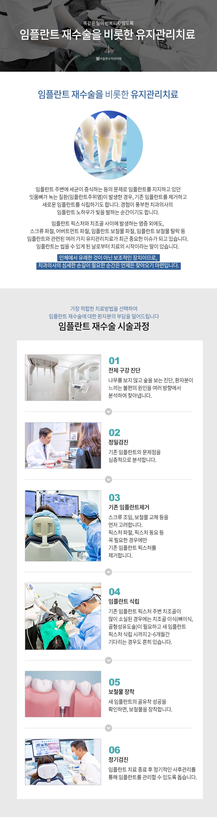 임플란트 재수술