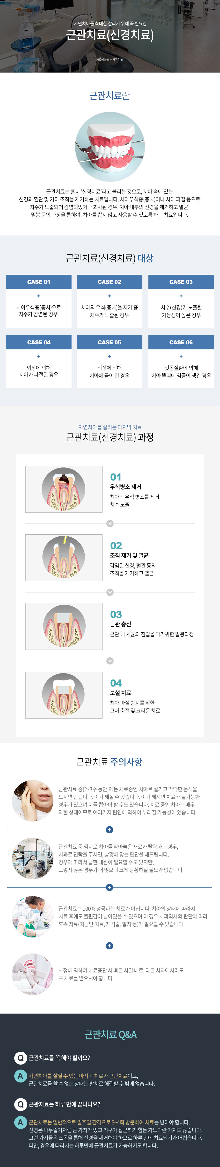 신경치료