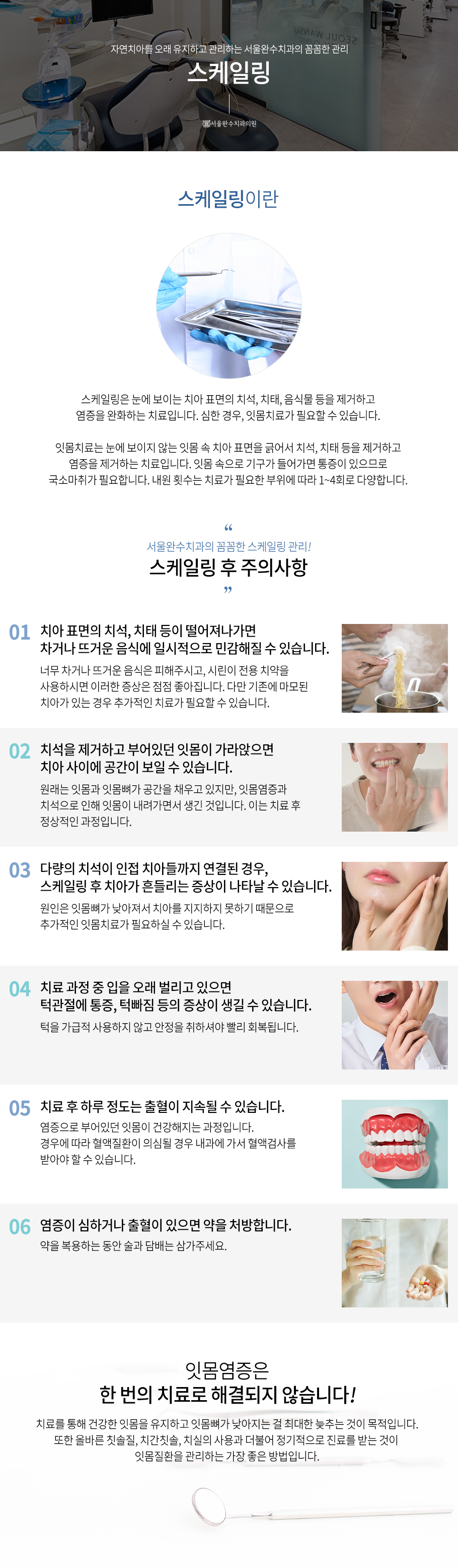 스케일링
